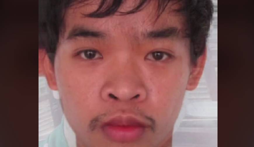 衝撃 26歳ベトナム人男性がルックスのせいで就職できないと整形手術したらこうなった Edamame 衝撃 26歳ベトナム人男性がルックスのせいで就職できないと整形手術したらこうなった Edamame