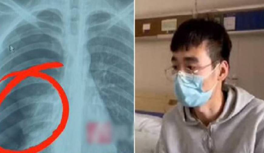 【マジか】25歳中国人男性が肺を損傷！その理由はカラオケで高音キーを熱唱したからだった！ edamame.